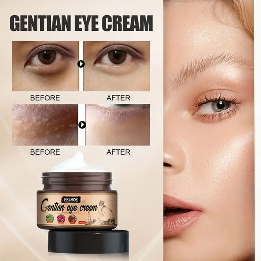 Gentian Milia Remover Eye Cream For Milia Spot Treatment