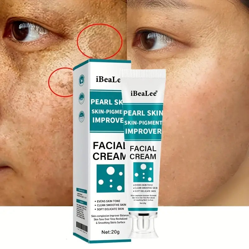 Freckle Cream, Firming Skin, Improving Skin Tone Uneven,Dark Spot Remover For Face, Radiant, Suitable For All Skin Types