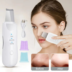 Ultrasonic Skin Scrubber Deep Face Cleaning Machine Peeling Shovel Facial Pore Cleaner Face Skin Scrubber Lift Beauty Instrument