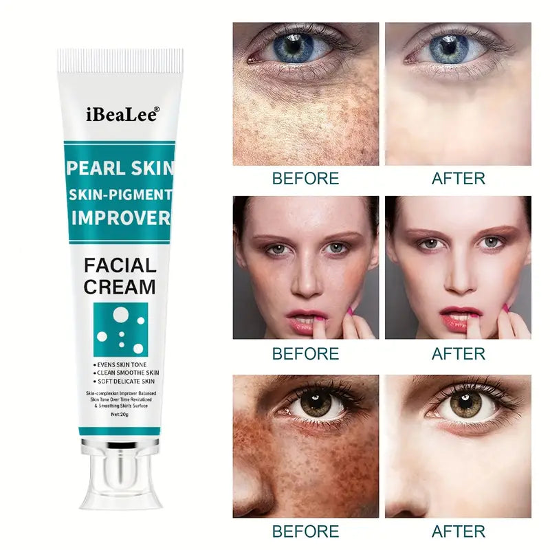 Freckle Cream, Firming Skin, Improving Skin Tone Uneven,Dark Spot Remover For Face, Radiant, Suitable For All Skin Types