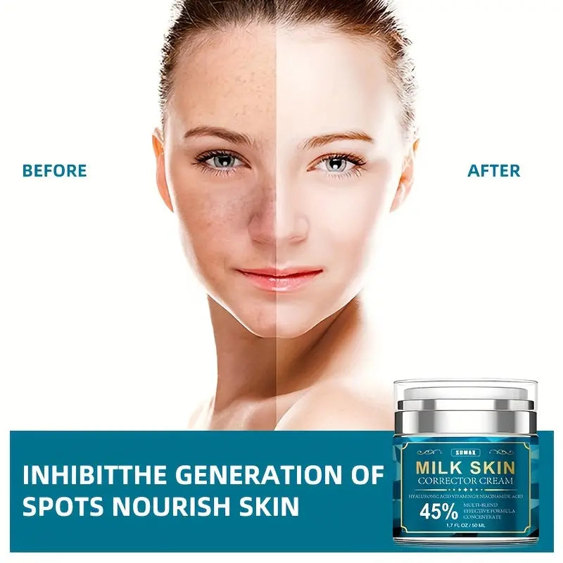 Brighten Your Skin: Dark Spot Fade Cream for Hyperpigmentation, Melasma, Freckles & Sun Spots - For Women & Men