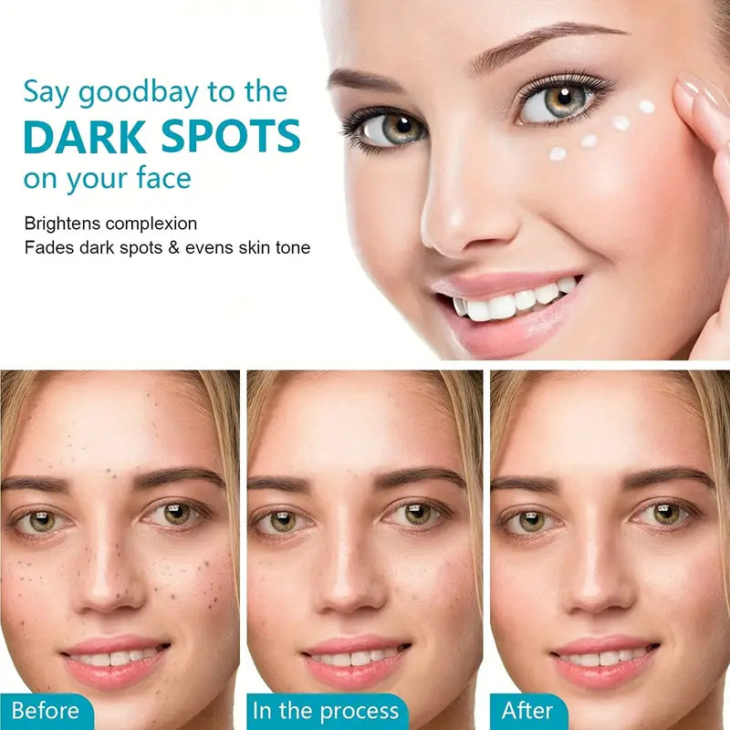 Dark Spot Fade Cream For Face, Body And Sensitive Areas - Natural Skincare For Underarms, Elbows & Privates