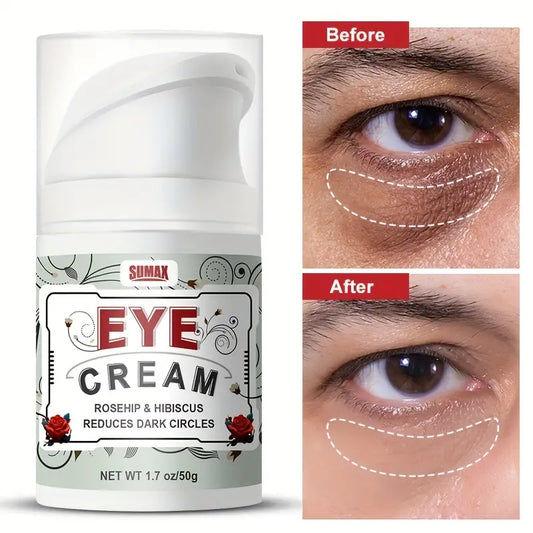 Eye Cream - Eye Cream For Dark Circles And Puffiness, Under Eye Cream, Anti Aging Eye Bag Cream, Improve The Look Of Fine Lines And Wrinkles